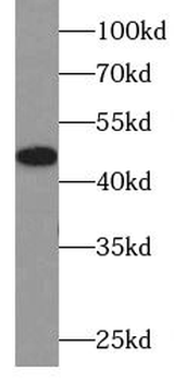 SLC2A1 Mouse Monoclonal Antibody