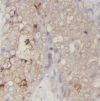 SLC2A1 Mouse Monoclonal Antibody