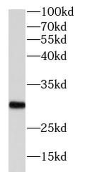 PGAM1 Rabbit Polyclonal Antibody