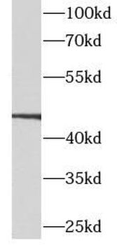 CALCRL Rabbit Polyclonal Antibody