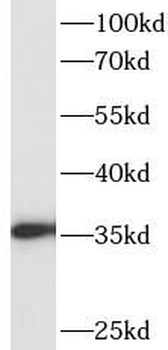 NOSIP Rabbit Polyclonal Antibody