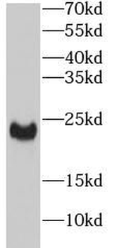 ANGPTL8 Rabbit Polyclonal Antibody