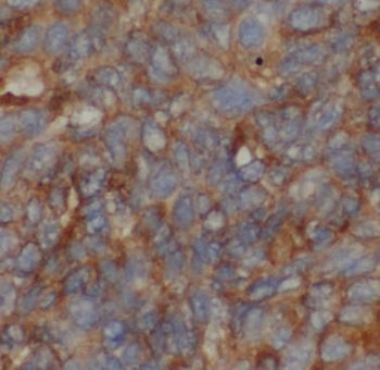 ANGPTL8 Rabbit Polyclonal Antibody