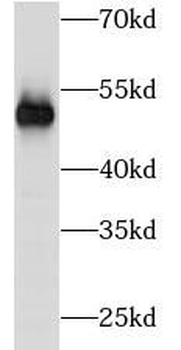 TUBB3 specific Mouse Monoclonal Antibody