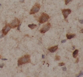 TUBB3 specific Mouse Monoclonal Antibody