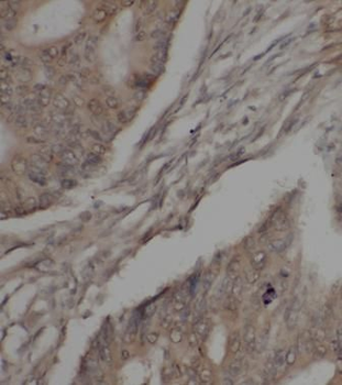 JAK1 Rabbit Polyclonal Antibody
