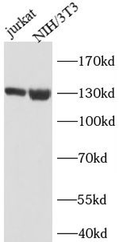 JAK1 Mouse Monoclonal Antibody