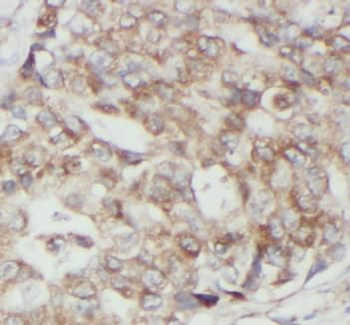 JAK1 Mouse Monoclonal Antibody