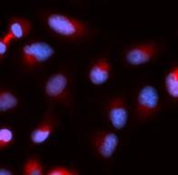 BIRC5 Rabbit Polyclonal Antibody