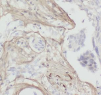 Collagen Type I Mouse Monoclonal Antibody