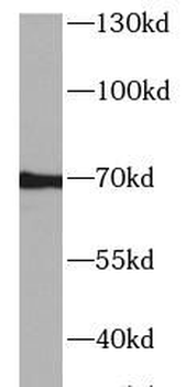 AHSG Rabbit Polyclonal Antibody
