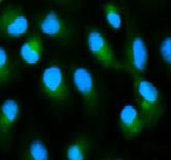 AHSG Rabbit Polyclonal Antibody