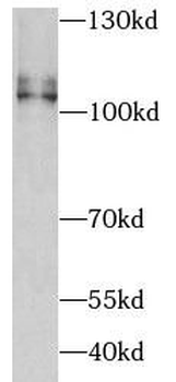 ATP2A2 Rabbit Polyclonal Antibody