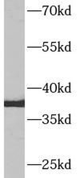AQP9 Rabbit Polyclonal Antibody