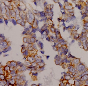 AQP9 Rabbit Polyclonal Antibody