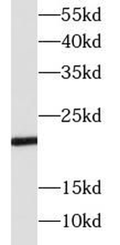 SOCS1 Rabbit Polyclonal Antibody