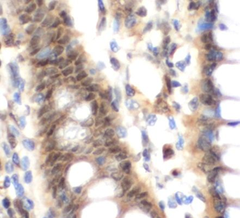 SOCS1 Rabbit Polyclonal Antibody