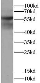Pan Keratin Rabbit Polyclonal Antibody