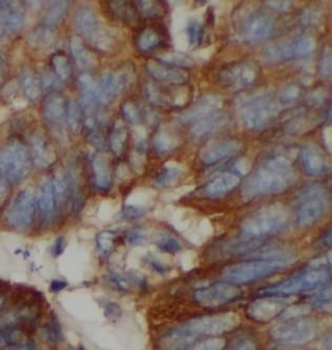 Pan Keratin Rabbit Polyclonal Antibody