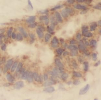 CASP3 Mouse Monoclonal Antibody