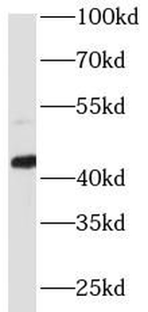 Phospho CREB1 (S133) Rabbit Polyclonal Antibody