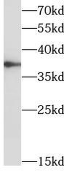 TOMM40 Rabbit Polyclonal Antibody