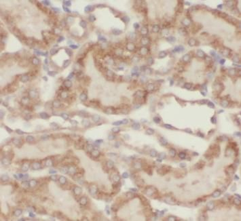 TOMM40 Rabbit Polyclonal Antibody