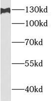 USP7 Rabbit Polyclonal Antibody
