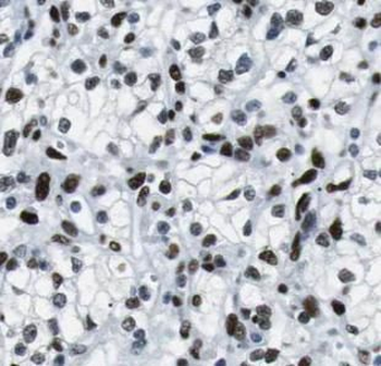 USP7 Rabbit Polyclonal Antibody