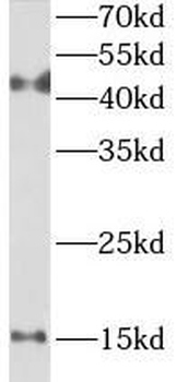 REG3A Rabbit Polyclonal Antibody