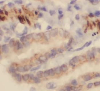 REG3A Rabbit Polyclonal Antibody
