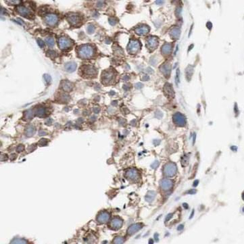HSP90AA1 Rabbit Polyclonal Antibody