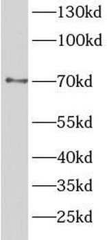 TAB2 Rabbit Polyclonal Antibody