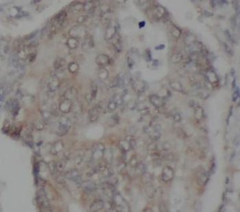 TAB2 Rabbit Polyclonal Antibody