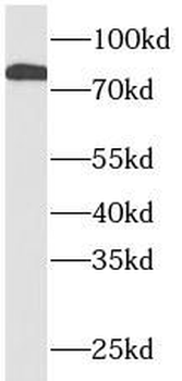 STAT1 Rabbit Polyclonal Antibody