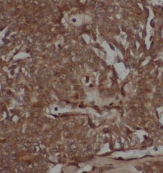 STAT1 Rabbit Polyclonal Antibody