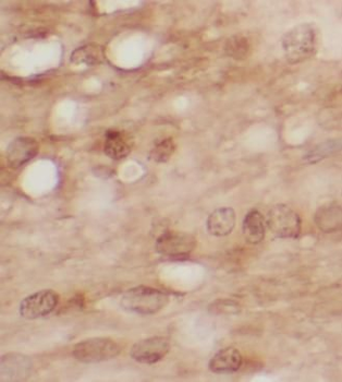 copeptin Rabbit Polyclonal Antibody