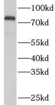 HSPA5 Rabbit Polyclonal Antibody