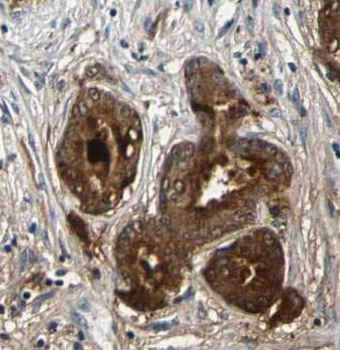 HSPA5 Rabbit Polyclonal Antibody