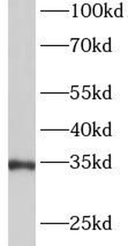 ANXA5 Rabbit Polyclonal Antibody