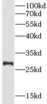PINK1 Rabbit Polyclonal Antibody
