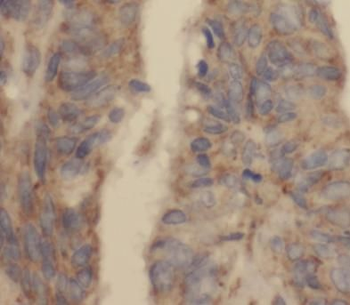PINK1 Rabbit Polyclonal Antibody