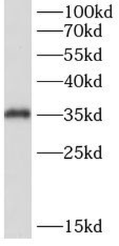 TK2 Rabbit Polyclonal Antibody