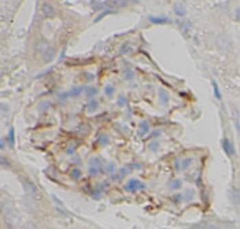 TK2 Rabbit Polyclonal Antibody