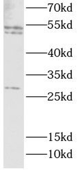 CASP1 Rabbit Polyclonal Antibody