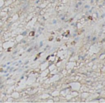 CASP1 Rabbit Polyclonal Antibody