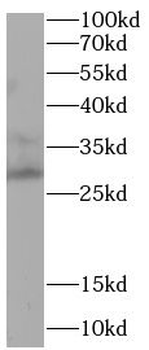 APOBEC3A Rabbit Polyclonal Antibody