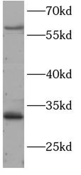 HSF2 Rabbit Polyclonal Antibody