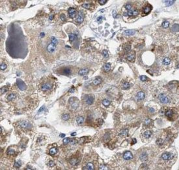 HSF2 Rabbit Polyclonal Antibody