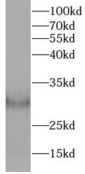 COL10A1 Rabbit Polyclonal Antibody